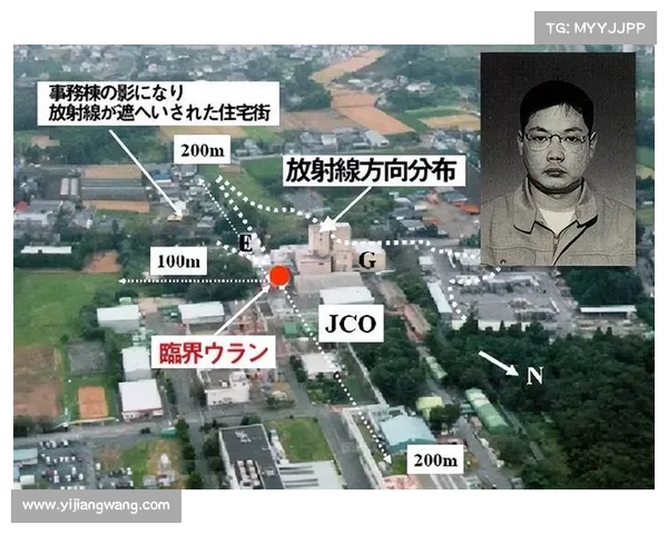 辐射治疗:优化效果,中了辐射也能康复 辐射治疗:优化效果,中了辐射也能康复